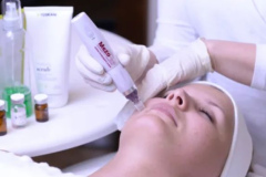 Mezopen-kategoria-kep